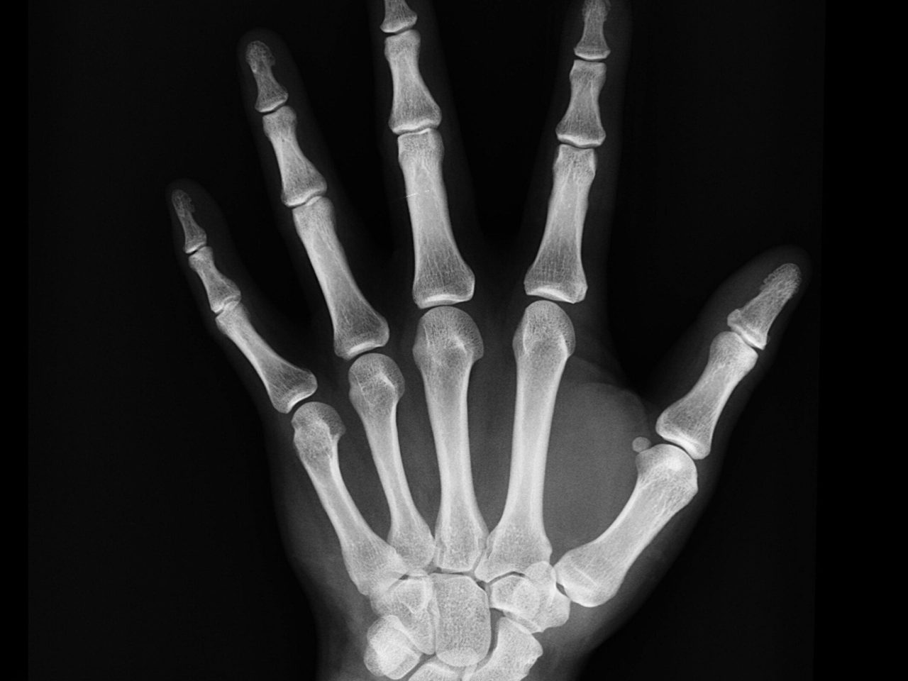 High-resolution X-ray capturing the bones of a human hand, displaying skeletal anatomy.