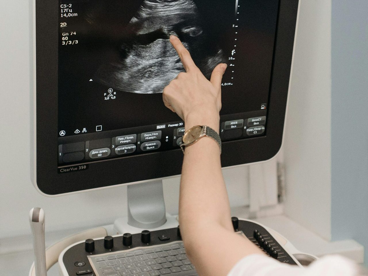 A medical professional analyzing an ultrasound image on a monitor in a clinical setting.